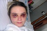 ضرب و شتم وحشیانه زن توریست پس از ساعت‌ها تعرض
